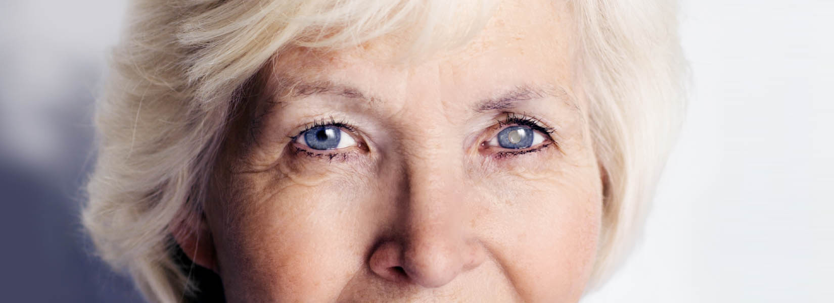 Cataract Surgery in North Dartmouth